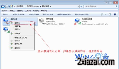 检查本地连接是否被禁用